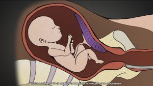 Koliko strasno zaista izgleda abortus